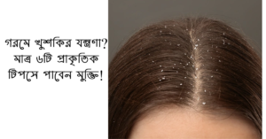Read more about the article গরমে খুশকির যন্ত্রণা? মাত্র ৬টি প্রাকৃতিক টিপসে পাবেন মুক্তি!